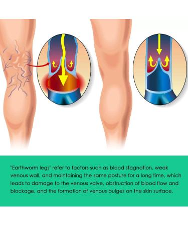  Katutude Veinopro Varicose Veins Treatment Soaps for Legs and All Skin Types (2 Pack) - Buy Online on GoSupps.com