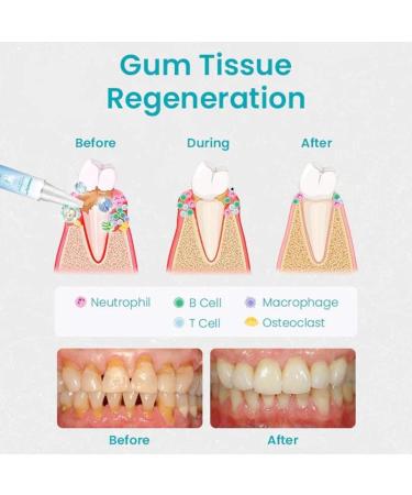 Buy Ceoerty & Dentizen Gum Shield Therapy Gel + Teeth Whitening Pen (2pcs) | Best Oral Care for Healthy Gums & Bright Smile - International Shipping Available - Buy Online on GoSupps.com