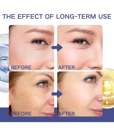 Retinol Face Cream - Anti Aging Face Cream - Anti Wrinkle Face Cream with Collangen - Anti Aging Face Moisturizer for Women with Hyaluronic Acid Niacinamide - Day Night Cream Tender Skin 50g - Buy Online on GoSupps.com