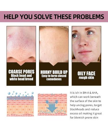 AHA 30%+BHA 2% Face Serum AHA Serum for Hydrated BHA Exfoliating Solution Hyalu B5 Serum AHA &BHA Serum to Reduce Fine Line and Minimise Pore Facial Serum Dark Spot Remover for Face Brightening Serum - Buy Online on GoSupps.com