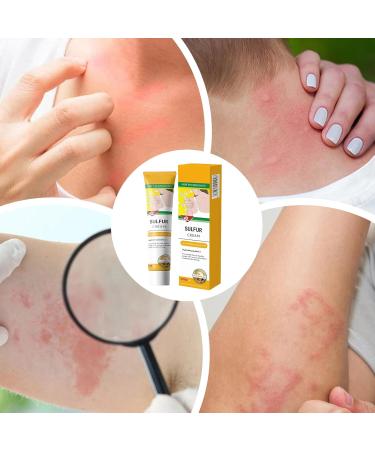  Zegaqae Anti-Itch Cream | Soothing Care 20g Fast-Absorbing Balm for Combination Oily and Sensitive Skin Post-Sports Recovery Outdoor Use - Buy Online on GoSupps.com