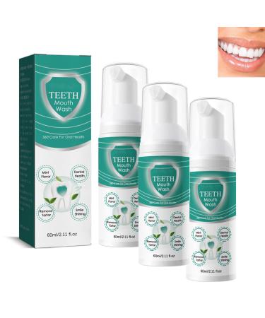 Awzlove teeth overall care mouthwash toothpaste Teeth Total Care Mundwasser 2024 Best Awzlove Teeth Mundwasser Hudos mouthwash for teeth loosens all oral problems lighten teeth (3PC)