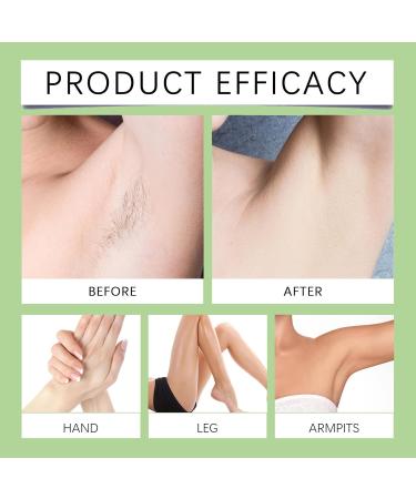 VKaoess Painless facial hair removal cream for women and men Gentle facial hair removal cream for the sensitive skin of the face chin and body Hair removal cream set for all skin types 1 piece - Buy Online on GoSupps.com