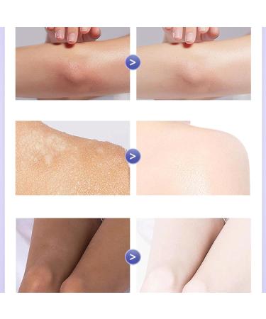 New Magical Whitening Body Lotion Whole Body Cold White Skin Cold White Full Body Whitening Cream New Cold White Skin All Over Whitening Nourishing Body Lotion For All Skin Types(200g 1pc) - Buy Online on GoSupps.com