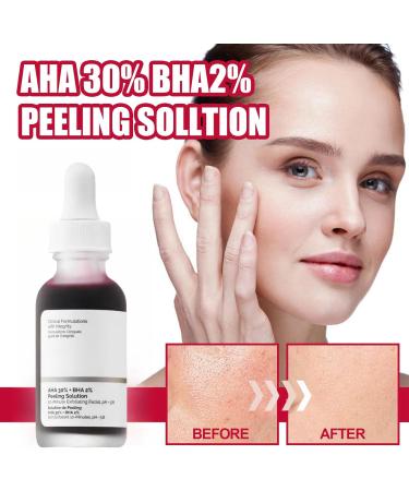 AHA 30% + BHA 2% Peeling Solution AHA Exfoliating Facial Serum BHA Face Serum for Women Soothing Skincare Serum for Face Peeling Brightening Serum for Fighting Blemishes & Reduces Pore Congestion - Buy Online on GoSupps.com
