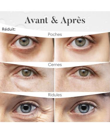 Patch Yeux Anti Cernes (30 paires) Masque Yeux avec Niacinamide et Acide Hyaluronique Patch Anti Cernes et Poches - Mix V3 - Buy Online on GoSupps.com