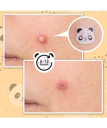 AUSLKA Panda Pimple Patches 120 Count - Hydrocolloid Spot Dots for Face Acne Absorbing Cover Patch - Blemishes and Pimple Stickers for Clear Skin - Pack of 1 - Buy Online on GoSupps.com
