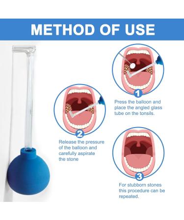 Effective Tonsil Stone Removal Tool - Fresh Breath Almond Sucker & Remover - Buy Online on GoSupps.com