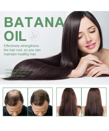 Natural Raw Batana Hair Oil Conditioner - Organic Hair Growth & Moisturizing Scalp Treatment for Men & Women - Prevent Hair Fall & Restore Damaged Hair 3.52FL. OZ - Buy Online on GoSupps.com
