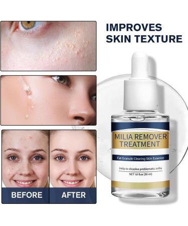 Moisturizing Facial Fluid Deep Hydration SERUM Brightening Facial Fluid Deep Hydration Lightweight Formula 30ml Daily Hydration and Lightweight Travel Moisturizer - Buy Online on GoSupps.com