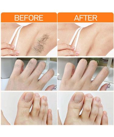 Barebliss Cr me d pilatoire pour le visage la l vre sup rieure la l vre sup rieure le menton la peau lisse durable pour tous les types de peau (3) - Buy Online on GoSupps.com