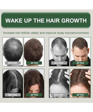 Tpubmity 2 x 60 ml hair growth oil rosemary oil for healthy hair and scalp hair care thicker hair growth for women and men 60 ml 2er Pack - Buy Online on GoSupps.com