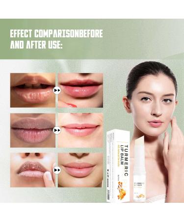 Lip Lightening for Dark Lips Moisturizing Lip Care Cream Lip Balm Stick Turmeric Lips Pink Bleaching Cream Balm Lip Salve for Chapped Lips Lip Repair Balm Lip Moisturizer Daily Lip Balm for Dry Lips - Buy Online on GoSupps.com