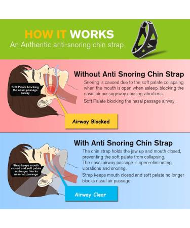 FOJOC Anti Snoring Chin Strap - Advanced Solution for Men and Women - Buy Online on GoSupps.com