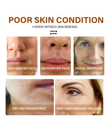 Retinol Facial Essence Gentle Moisturizing Replenishing Moisture Pore Minimizing Evening Skin Facial Serum 30ml - Buy Online on GoSupps.com