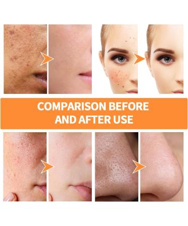 Green Tomat Clay Mask Pore Cleanser Korean Clay Mask For Deep Pore Cleansing Green Tomat Face Masks Skincare Facial Clay Mask for Pores Acne Face Mask Natural Face Mask Clay Deep Cleansing Face Mask - Buy Online on GoSupps.com