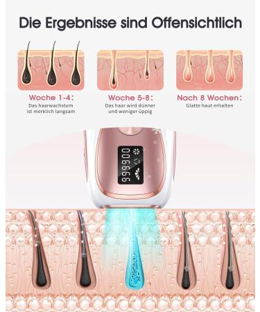 ZKMAGIC IPL Hair Removal Device - 999 900 Pulses 5 Energy Levels Cooling Function | Pain-Free Laser Hair Removal for Women & Men - Face Armpits Legs & Body (Gold) - Buy Online on GoSupps.com