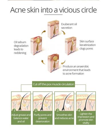 AICHUN BEAUTY Anti-Acne Facial Serum with Aloe Vera & Salicylic Acid 30ml for Damaged Skin Repair | International Shipping Available - Buy Online on GoSupps.com