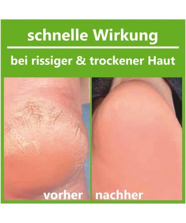 Buy Bathing Beach Menthol Foot Cream 100ml - Nourishing Soothing Relief for Tired Feet - International Shipping Available - Buy Online on GoSupps.com