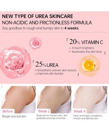 Keratosis Pilaris Improvement Body Cream - Body Moisturiser - Body Creams for Women - Firming Body Lotion for Soothing and Repairing - Dry Skin Moisturiser for Skincare - Nourishing & Moisturing - Buy Online on GoSupps.com