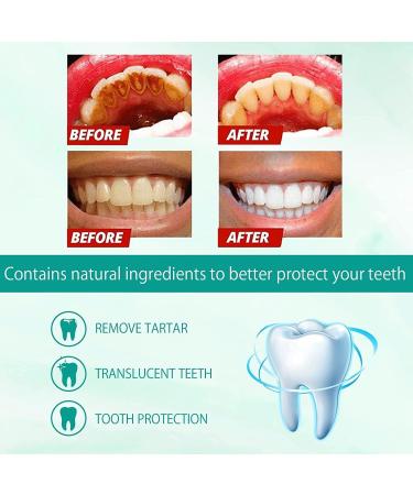 Teethaid Mouthwash & Whitening Foam Toothpaste - 360 Care for Oral Health (2pcs) | International Shipping - Buy Online on GoSupps.com