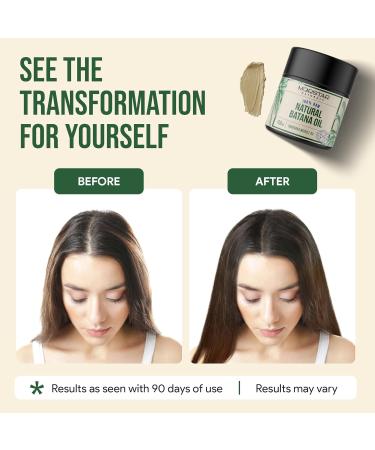 Batana Oil - Dr. Sebi Approved Raw Batana Oil for Hair Growth - 3.4 oz | Buy Internationally - Buy Online on GoSupps.com