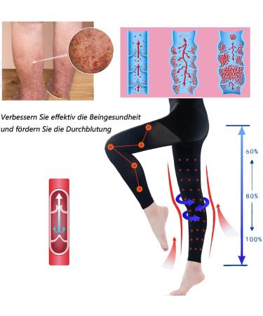 MDRCG 23-32 mmHg Medical Compression Stockings for Men & Women | Long Support Socks for Pregnancy & Varicose Veins | XXL Black - Buy Online on GoSupps.com