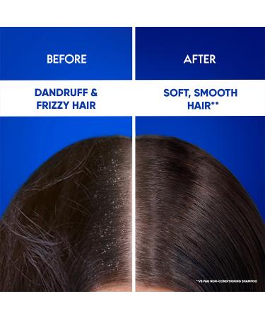 Buy Head & Shoulders Smooth and Silky 2-in-1 Anti Dandruff Shampoo + Conditioner 180ml | International Shipping Available - Buy Online on GoSupps.com