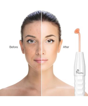 NewWay High Frequency Facial Wand: Skin Tightening & Hair Follicle Therapy - Buy Online on GoSupps.com