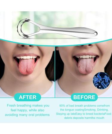 Stainless Steel Tongue Cleaner Set - 4 Piece Tongue Scraper for Bad Breath Relief | Ideal Hygiene Product for Men & Women - Buy Online on GoSupps.com