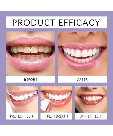  ZLHHRZJX Lysozyme Whitening Toothpaste Purple Color Corrector Toothpaste For Yellow Teeth Purple Toothpaste Gel With Stain Remover Whitening Toothpaste Fresh Breathing Oral Care - Buy Online on GoSupps.com