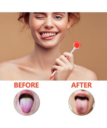 Milist 2nd Tongue Cleaning Brush - Premium Stainless Steel Tongue Scraper for Adults | Effective Nanoplasty Cleaning Tool - Buy Online on GoSupps.com