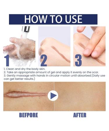 Pregnancy Scar Gel - Moisturizing & Rejuvenating Skincare Must-Have for First Trimester - Dark Blue - Buy Online on GoSupps.com