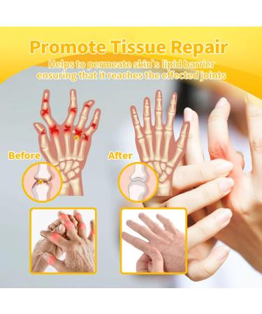 Luhaka Botulinum Toxin & Bee Venom Pain-Relief Bone Healing Cream Bee Venom Cream Effectively improve joint mobility (1PC) - Buy Online on GoSupps.com