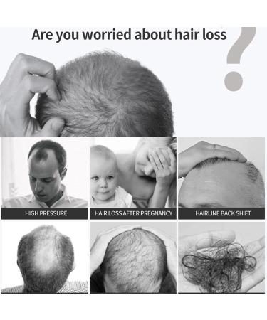 fanelod Hair Growth for Women - Natural Ginger Hair Growth Serums 20ML Biotin Hair Growth - Nourishing Ginger - Buy Online on GoSupps.com