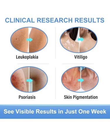 Vitiligo Cream for Skin Pigmentation | Reduce White Spots Treatment - Buy Online on GoSupps.com