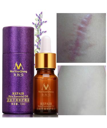 10ml Lavender Scar Oil for Men - Skin Care Solution for Scars, Personal Care - Brown - Buy Online on GoSupps.com