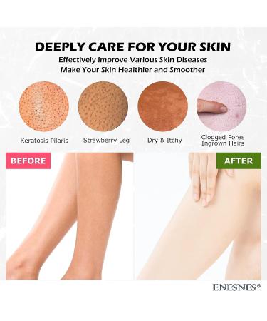 ENESNES 4PCS Thickened Exfoliating Glove Set for Shower | Korean Body Scrubber Mitt | Dead Skin Remover & Exfoliator | Ideal for Spray Tan Removal & Keratosis Pilaris - Buy Online on GoSupps.com