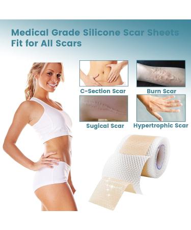 Medical-Grade Silicone Scar Sheets for Surgical Scars, Keloids, and Stretch Marks - 1.6 x 120 inches - Buy Online on GoSupps.com