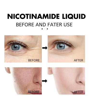 Spot Corrector for Face | Anti-Aging Serum with Nicotinamide | Hydrating & Tightening Essence for Fine Lines - 3 Pcs - Buy Online on GoSupps.com