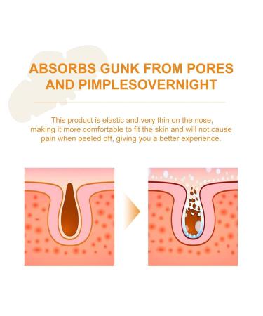 Blackhead Removal Nose Patches - Deep Cleansing Pore Strips for Instant Unclogging & Oil Removal (20 Patches - Buy Online on GoSupps.com