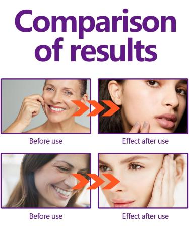 Instant Face Lift Cream Women's Instant Face Lift Serum Firming/Tightening Skin Targeting Sagging Skin and Fine Lines Gentle Wrinkles Contains Moisturizing Formula 30ml 1PCS 1 Ounce (Pack of 1) - Buy Online on GoSupps.com