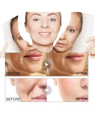  Grgowe 2 Pieces Ginseng Face Serum Essence Ginseng Peptide Ginseng Anti-Wrinkle Serum Ginseng Anti-Aging Essence For All Types Of Leather Reduces Fine Lines - Buy Online on GoSupps.com