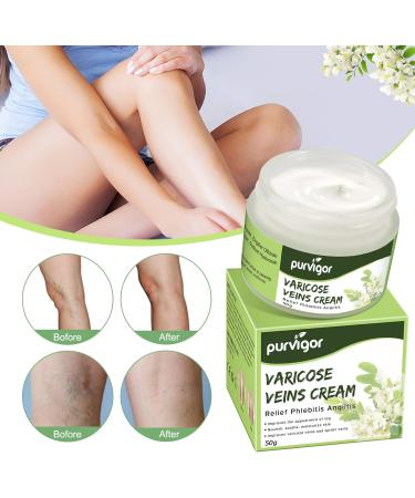 Varicose Vein Cream for Soothing Relief and Improved Capillary Health - Buy Online on GoSupps.com