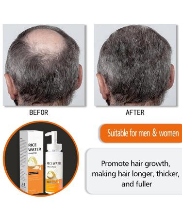 Rice Water Shampoo for Hair Loss | Nourishing Hair Regrowth Treatment for Thinning & Balding - Buy Online on GoSupps.com