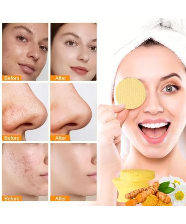 Kojic Acid & Turmeric Cleansing Pads Kojic Acid And Turmeric Pads Turmeric Exfoliating Pads For Fades Dark Spots Face Exfoliator Pad Helps Balance Oil And Water - Turmeric Kojic Acid Face Pads - Buy Online on GoSupps.com