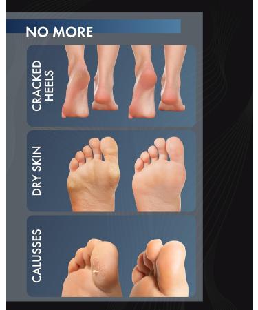 Shop Corn Skin Socks | Effective Corneal Removal Foot Mask | Baby Foot Peel Socks - Extra Long (Up to Size 47) - Buy Online on GoSupps.com