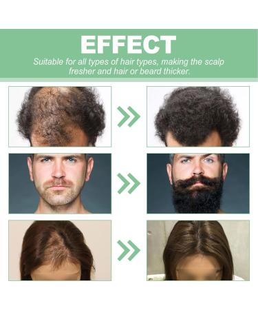 Hair Growth Serum Beard Hair Regrowth Treatment for All Hair Beard Hair Regrowth Treatment for All Hair - Buy Online on GoSupps.com