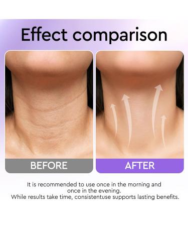 Neck Firming Cream, Retinol Cream for Face&Neck for Tightening Firming Anti-aging Face Moisturizer with Retinol Collagen & Hyaluronic Acid Lift Wrinkle for Women and Men 1.7 Fl. Oz. - Buy Online on GoSupps.com