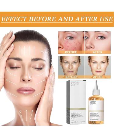 7% Glycolic Acid Toning Solution Glycolic Sour 7 Toner Glycolic Acid Toning Solution Glycolic Acid 7% Toning Resurfacing Solution Glycolic Acid Toner Glycolic Acid Hydrating Toner - Buy Online on GoSupps.com